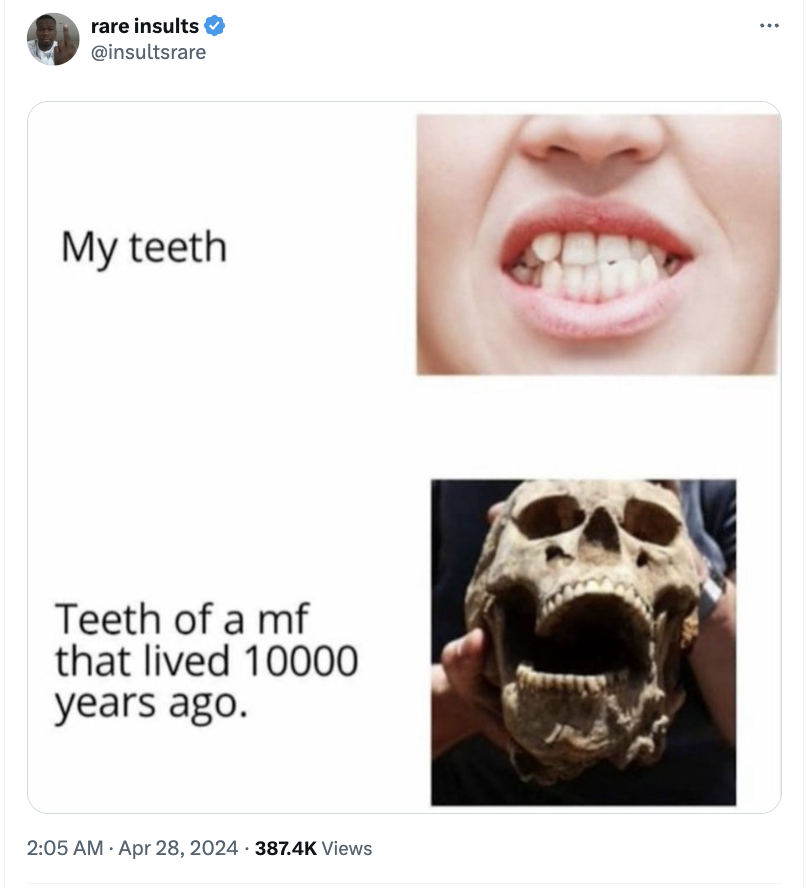 teeth of a mf who lived 10000 years ago - rare insults My teeth Teeth of a mf that lived 10000 years ago. Views